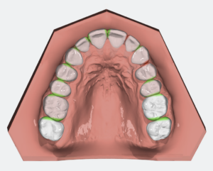 OnyxCeph - Alignery in office Staging