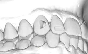 OnyxCeph - Alignery in office - attachment