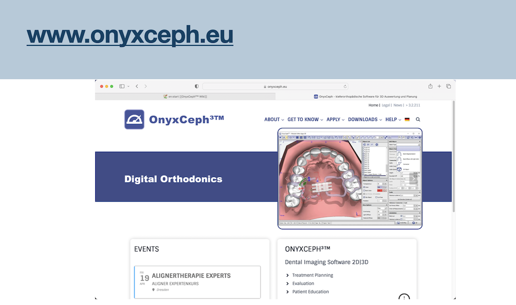 OnyxCeph - stona producneta